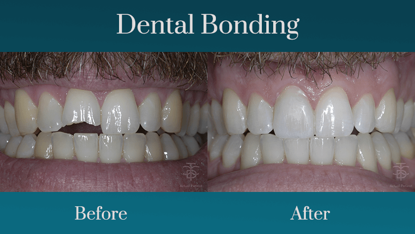 cosmetic dentistry procedures